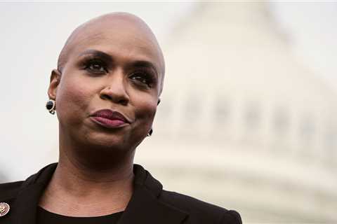 What’s the Big Deal About a Woman Being Bald?