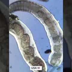 US vs UK Tap Water Under A Microscope