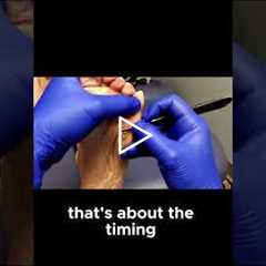 How Regular Trimming Helps Manage Painful Calluses Effectively #FootCareTips #CallusRelief