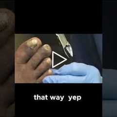 Talking Small Town Life and Big City Costs During Toenail Care