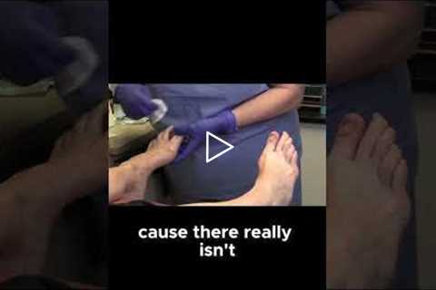 Why People Hide Their Feet and How to Feel Comfortable Again! #FeetConfidence  #MentalHealth