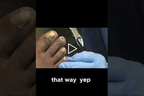 Talking Small Town Life and Big City Costs During Toenail Care