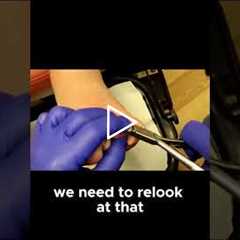 How Regular Nail Trims Can Prevent Painful