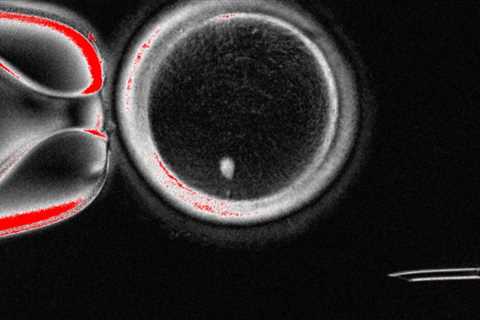 Human Eggs Created from Skin Cells in Breakthrough Study