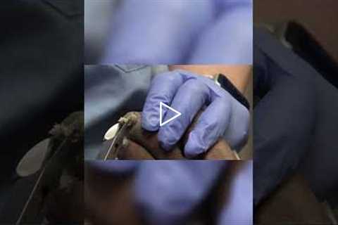 Transitioning to Diabetic Socks A Necessary Step