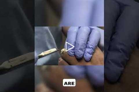 Managing Foot Health Insights from a Diabetic