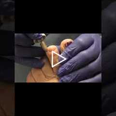 The Importance of Managing Diabetes 💉🌟