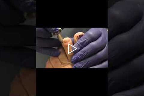 The Importance of Managing Diabetes 💉🌟