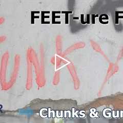 FEET-ure Friday | Genetic Calluses & Thick Nail Trimming | Podiatrist Explains | Chunks & Gunk #27
