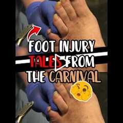Foot Injury Tales from the Carnival 🎡🦶