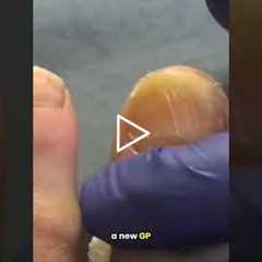 The Struggle of Finding a New GP 🏥