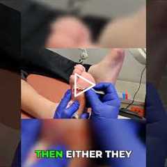 Should I Take Antibiotics? Doctor’s Advice 💊👨‍⚕️