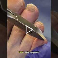 “I’m Too Scared to Cut My Toenails” — You’re Not Alone 👣😬