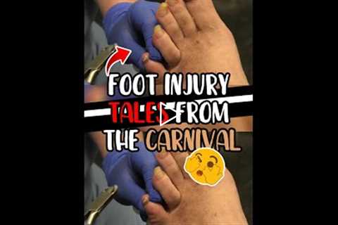 Foot Injury Tales from the Carnival 🎡🦶