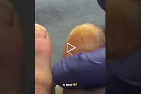 The Struggle of Finding a New GP 🏥