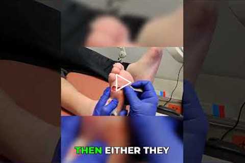 Should I Take Antibiotics? Doctor’s Advice 💊👨‍⚕️