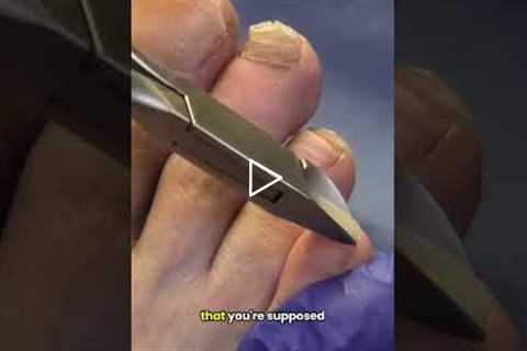 “I’m Too Scared to Cut My Toenails” — You’re Not Alone 👣😬