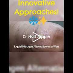 Treating Warts Innovative Approaches! ❄️✨