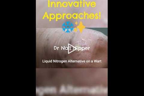 Treating Warts Innovative Approaches! ❄️✨
