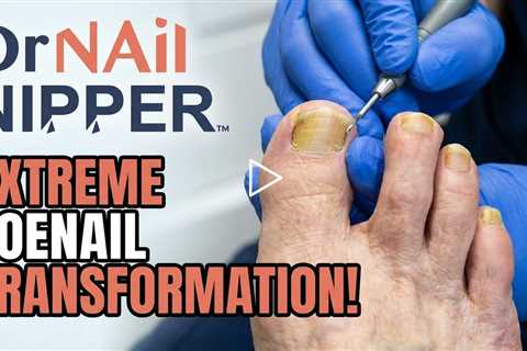 How Often Should You See a Podiatrist? (2.5-Month Foot Care Visit)