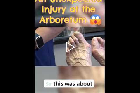 An Unexpected Injury at the Arboretum 😱