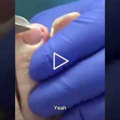 The Hidden Downsides of Compression Socks 👀