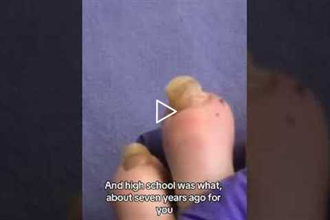 Young Athlete’s Damaged Toenail — Trauma or Fungus? 👟
