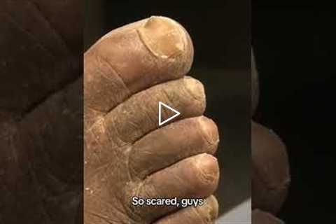 Monthly Foot Care Matters More Than You Think