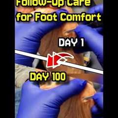 Painful Callus Relief (We’re Not Done Yet 👀) | Follow-Up Care for Foot Comfort