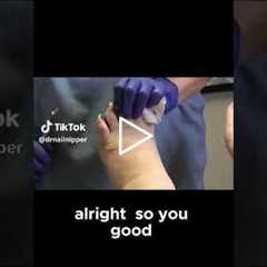 Why You Shouldn't Skip Your Toenail Appointments, Severely Overgrown Nails Finally Trimmed #nailcare