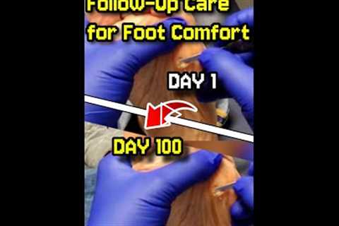 Painful Callus Relief (We’re Not Done Yet 👀) | Follow-Up Care for Foot Comfort