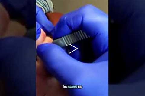 Identifying and addressing bleeding in callus tissue