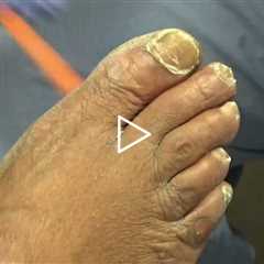Former Shelter Resident Returns for Foot Care ❤️