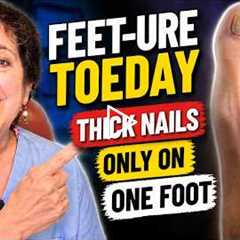 FEET-ure Toeday |  Thick Nails Only On One Foot