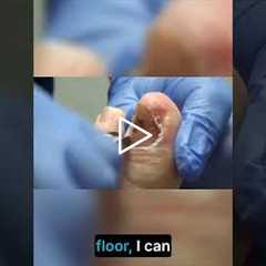 Injury Stories How Accidents Happen!  Senior Patient Explains How Her Leg Injury Happened