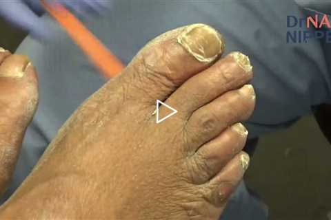 Former Shelter Resident Returns for Foot Care ❤️