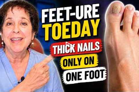 FEET-ure Toeday |  Thick Nails Only On One Foot