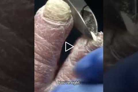 From cute feet to the ugliest part of the body, let's talk about feet