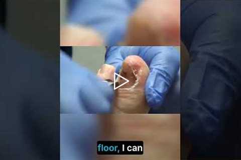 Injury Stories How Accidents Happen!  Senior Patient Explains How Her Leg Injury Happened