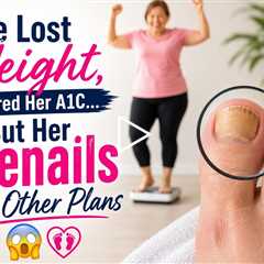 She Lost Weight, Lowered Her A1C… But Her Toenails Had Other Plans 😳🦶