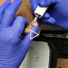 She Said Doctor Visits Were Her Social Life… Then We Saw Her Toenails 🦶😳