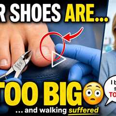 He Bought Shoes Too Big… Then Walking Became a Problem 👟🦶