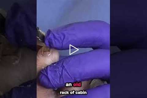 Talking Investments While Trimming Thick Toenails