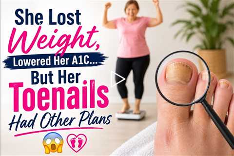 She Lost Weight, Lowered Her A1C… But Her Toenails Had Other Plans 😳🦶