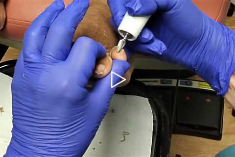 She Said Doctor Visits Were Her Social Life… Then We Saw Her Toenails 🦶😳