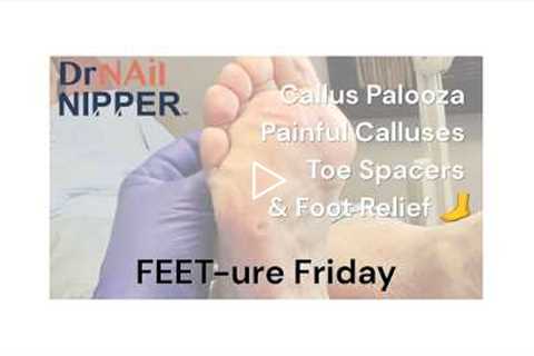FEET-ure Friday | Callus Palooza | Painful Calluses, Toe Spacers & Foot Relief 🦶