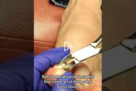 Nobody Warns You About Stroke Recovery 😢🧠