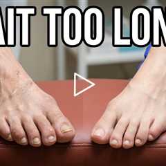 She Waited 3 Months... Was That TOO LONG? 👣 Medicare Timing Explained