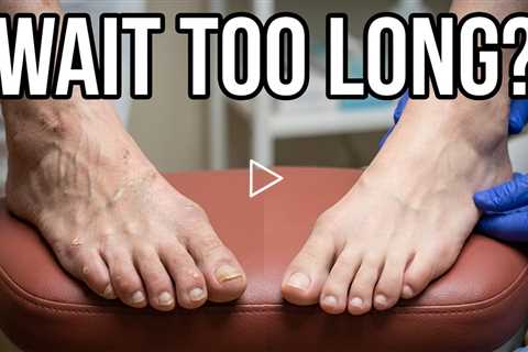 She Waited 3 Months... Was That TOO LONG? 👣 Medicare Timing Explained